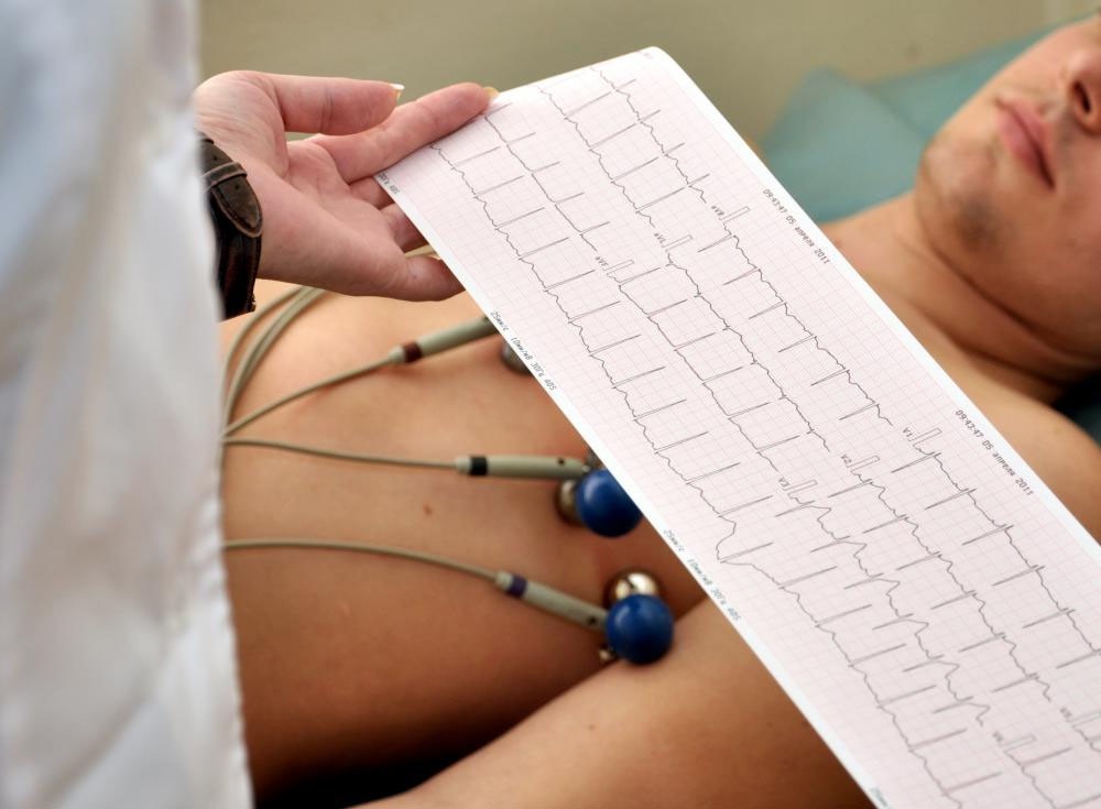 Electrocardiogramă efectuată la cabinet